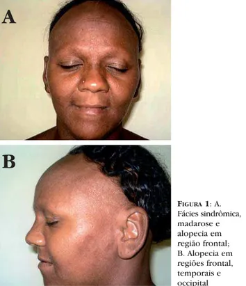Figura 3: Biopsia de couro