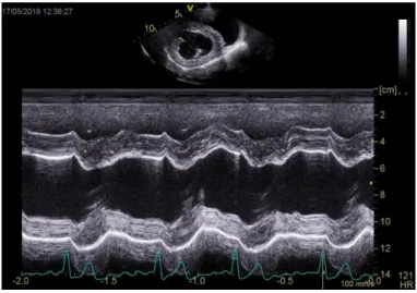 Figure 4. Left ventricular M-mode image. Courtesy of Elizabeth Bode, University of Liverpool