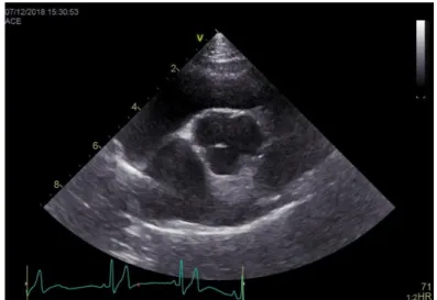 Figure 5. Representation of a right parasternal short-axis view used for measuring the LA:Ao  ratio