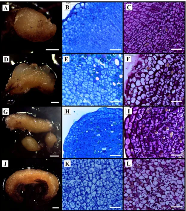 Figura  17.  Análise  anatômica  e  histoquímica  (com  Periodic  Acid  Schiff  –  PAS)  de  diferentes linhagens de calos obtidos a partir de tecidos foliares de macaúba (Acrocomia 