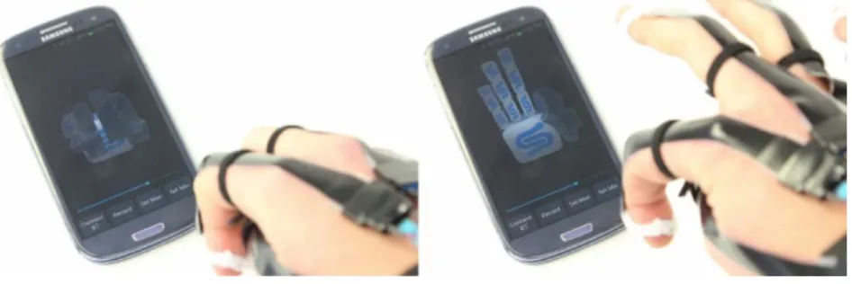 Figura 2.11 - Aplicação dos sensores Stretch Sense para monitorização dos movimentos dos dedos