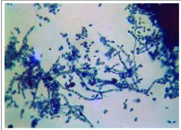 Figura 4: Micromorfologia da colônia – filamentos septados  acastanhados, blastosporos e artrosporos / Figure 4: Micromorphology