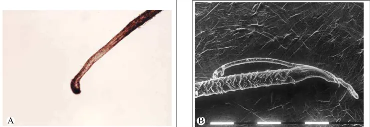 Figura 2 (caso III-21): 2a: Microscopia óptica (MO) de fio de cabelo com ausência de bainha radicular interna e externa e enrugamento da cutícula na porção proximal do bulbo 2b: Microcopia eletrônica de varredura (MEV) de fio de cabelo com ausência da bain