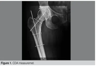 Figure 1. CDA measuremet.