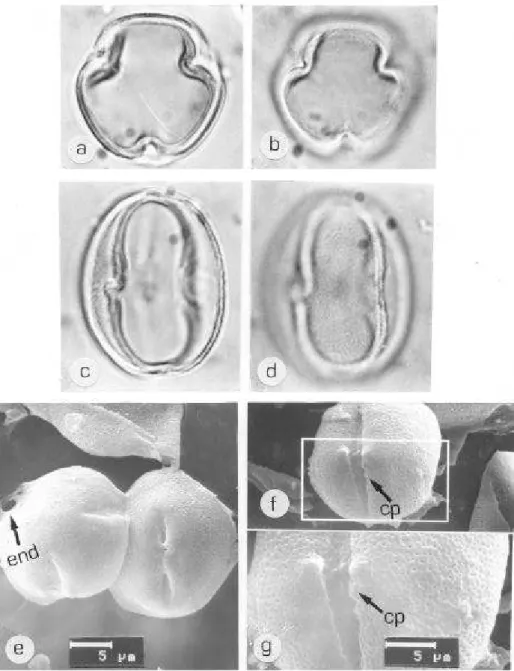 Figura 1. Pólen de Bocoa alterna (Benth) Cowan. ML: A. VP, corte óptico. B. Idem, aspecto da ornamentação da exina