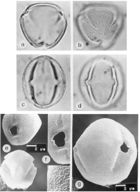Figura 2. Pólen de Bocoa racemulosa (Huber) Cowan. ML: A. VP, corte óptico; B. Idem, aspecto da ornamentação da exina; C