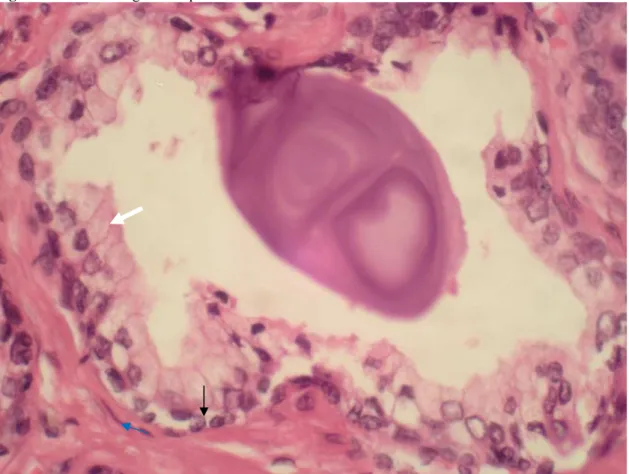 Figura 01 - Fotomicrografia da próstata normal 