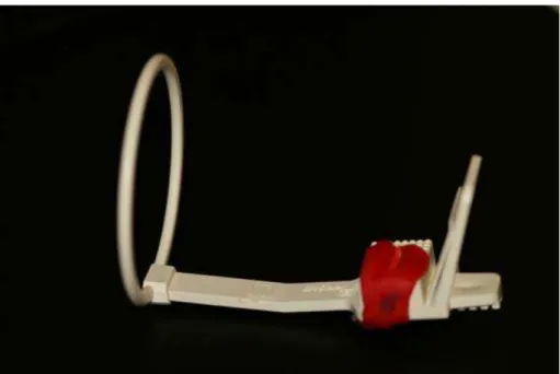 ILUSTRAÇÃO 7: Posicionador individual oclusal em acrílico (“stent”ou “jig”) acoplado ao  posicionador radiográfico  para execução da técnica periapical da bissetriz