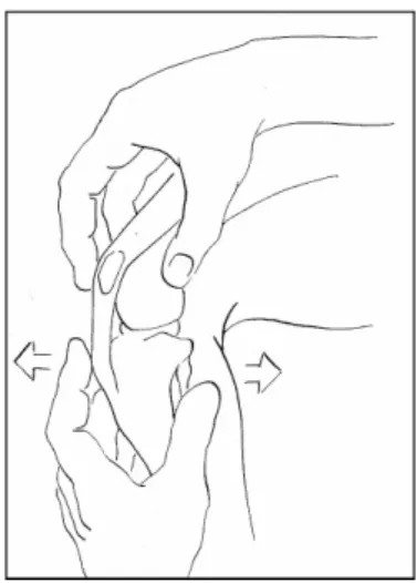 Figura 8: Realização do teste de movimento de gaveta. (imagem retirada de Vasseur, 2003) 