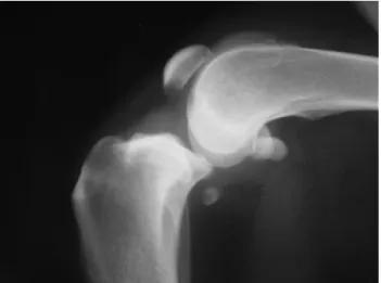 Figura 11:  Radiografia  com  compressão  tibial  de  um  canídeo com rotura do ligamento cruzado anterior