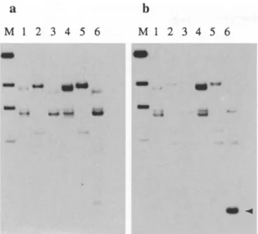 Fig. 2 a,b  Southern-blot hybridization showing control  and  5-AC-  treated triticale rDNA restriction patterns