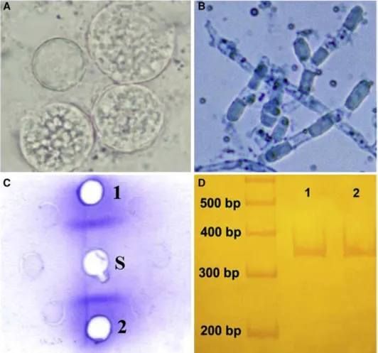 Fig. 2. Laboratory diagnosis of coccidioidomycosis. (A) Direct microscopy of sputum sample with spherules filled with endospores