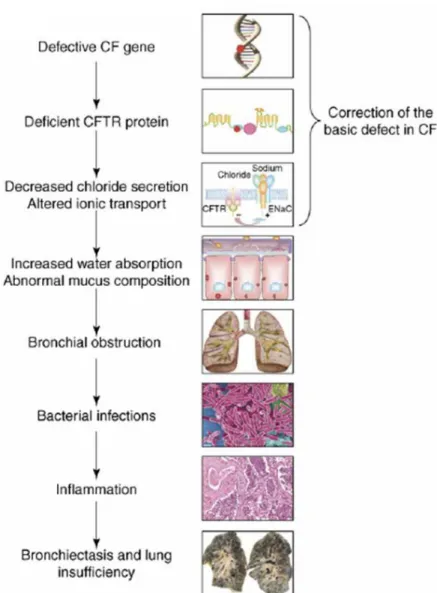 Figure  I.1.  The CF pathogenesis cascade in the lung.  A defective CFTR  gene leads to an absent or deficient CFTR protein