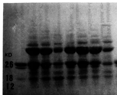 Figura 2 - Eletroforese  em  gel  de  poliacrilamida  das  proteínas  solúveis  de  cinco  espécies  do  gênero  Dioclea