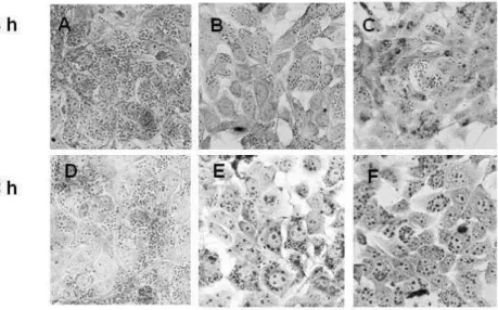 Figure  2.  Light  microscopy  of  Trypanossoma  cruzi-infected  LLCMK2  cells  treated with GaEPL for 24 (A, B, C) and 48 h (D, E, F) at 37 ºC