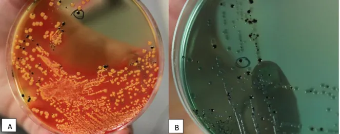 Figura 4 Aspeto de colónias sugestivas da presença de Salmonella sp. nas amostras testadas em Agar  XLD (A) e Agar Hektoen (B)