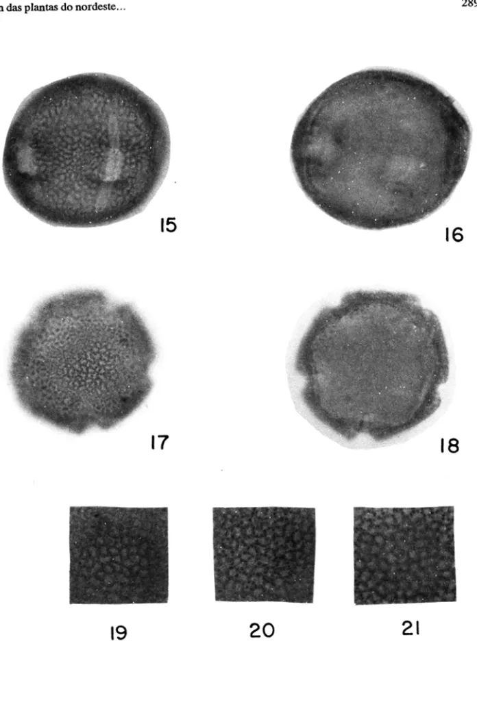 Fig.  15  a  18 - Waltheria  indica;  fig o 19  a  21  - detalhes  de parte da exina de W