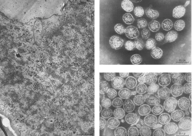 Figura 3. (a) Seção ultrafina de células do parênquima esponjoso de folhas de tabaco repletas de vesículas  contendo  partículas  virais  (setas  pretas)