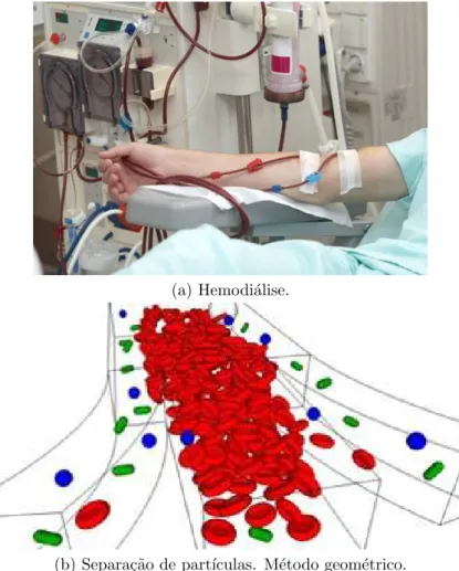 Figura 10: Aplica¸c˜oes do m´etodo de separa¸c˜ao de part´ıculas na medicina