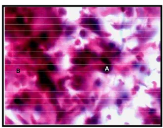 FIGURA 10 –  Fotomicrografia de lâmina de um animal do grupo  GE3D. NOTA: Lâmina corada pela HE mostrando  in-flamação crônica moderada (A – polimorfonuclear)