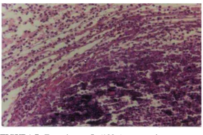 FIGURA 7 - Fotomicrografia (100 x) em zona de anastomose