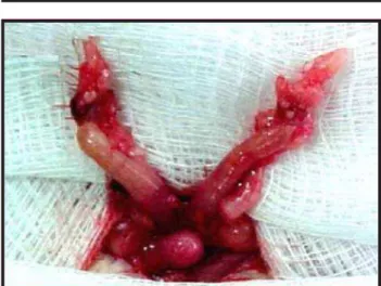 FIGURA 1 – Exposição dos ovários, útero e bexiga.