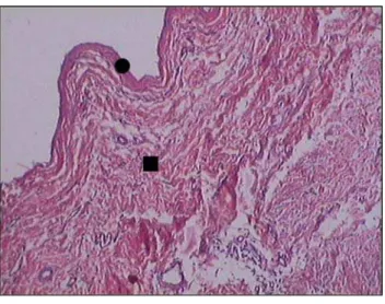 FIGURA 2 - Fotomicrografia de corte histológico de veia