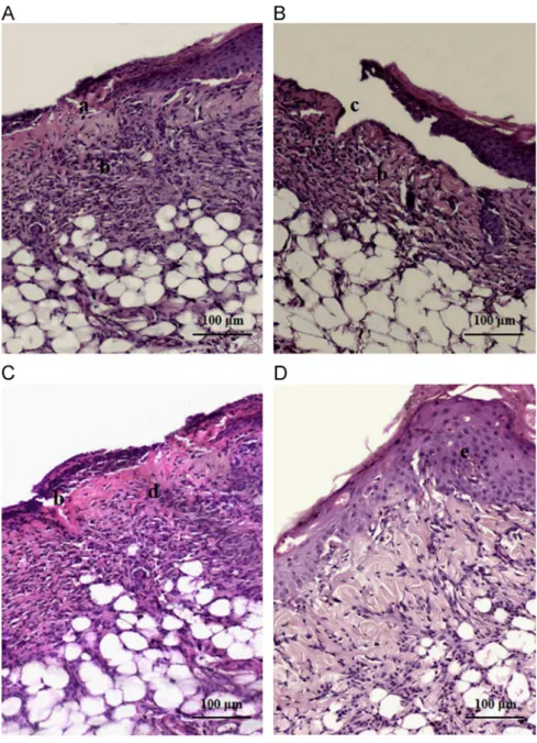 Fig. 5. Skin sections in the group treated with EOLS 100% (A, B and C) and EOLS 50% (D) on day 7 in different skin irritation models: (A) one-dosage irritation to healthy skin;