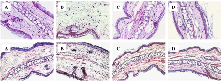 Fig. 5. Histological sections of mouse ear from TPA-treated (upper panel) or oxazolone-treated (lower panel)