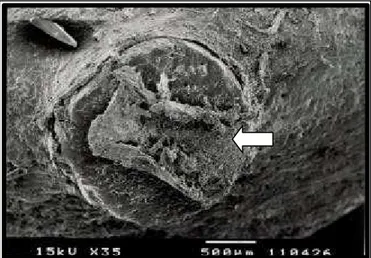 FIGURA 4 - Eletromicrografia de varredura do implante à base de fosfato de cálcio, em rádio de coelhos