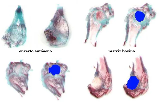 FIGURA 4 – Fotografia das imagens digitalizadas das lâminas histológicas dos côndilos
