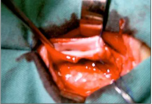 FIGURA 2 - Indução da estenose com sutura contínua com fio de algodão 3-0.