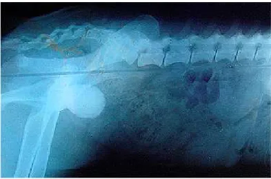 FIGURA 4 - Urografia excretora feita com três meses do transplante, dentro da