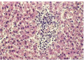 FIGURA 6 - Gráfico de sobrevida no terceiro experimento.FIGURA 4 - Microscopia – Tumor de Walker no fígado.