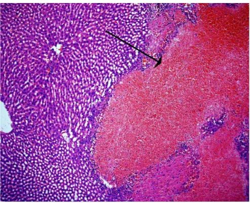 FIGURA 2 – Corte histológico do fígado