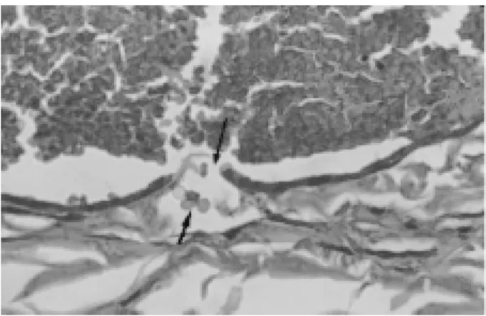 FIGURA 5- Fotomicrografia mostrando detalhe da lesão na parede vascular com extravasamento de células (setas).