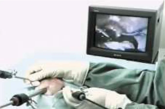 FIGURA 1 - Imagem externa do procedimento mostrando o posicionamento dos trocaters na cavidade abdominal do rato.