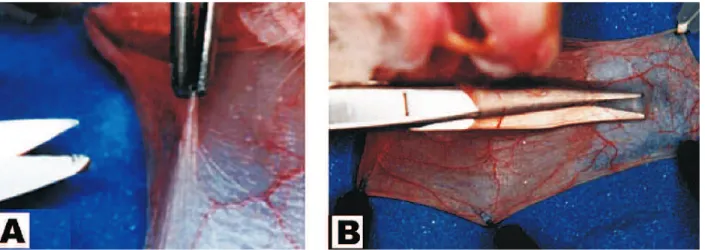 FIGURA 3 – Dissecção do subepitélio da bolsa jugal do hamster. A – Pinçamento da primeira camada epitelial da parede da bolsa.