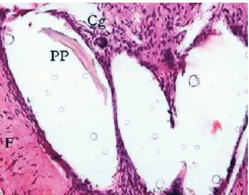 FIGURA 5 - Fotomicrografia mostrando reação inflamatória leve em torno dos orifícios onde estava a prótese de polipropileno (PP), dissolvida parcialmente pelo xilol; Observar presença de fibrose densa (F) e raras células gigantes multinucleadas (Cg)