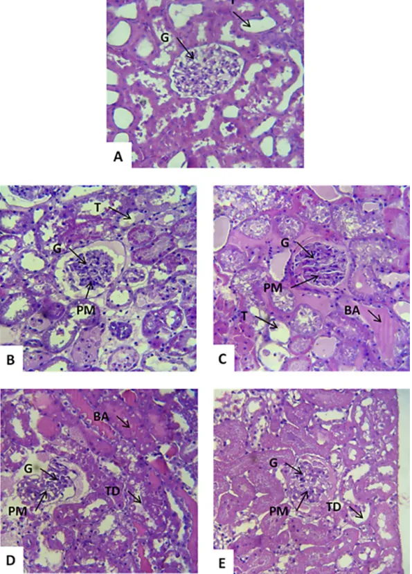 Fig. 5. Renal cortical sections of rats stained with hematoxylin–eosin (n = 6). (A) The sections were obtained from the left kidney incubated with Krebs solution (control) for 120 min showing a normal appearance for tubules (T) and glomerulus (G)