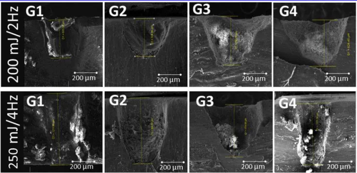 FIG. 4. Scanning electron micrographs of the border of the cavity treated with both parameters used in group G4.