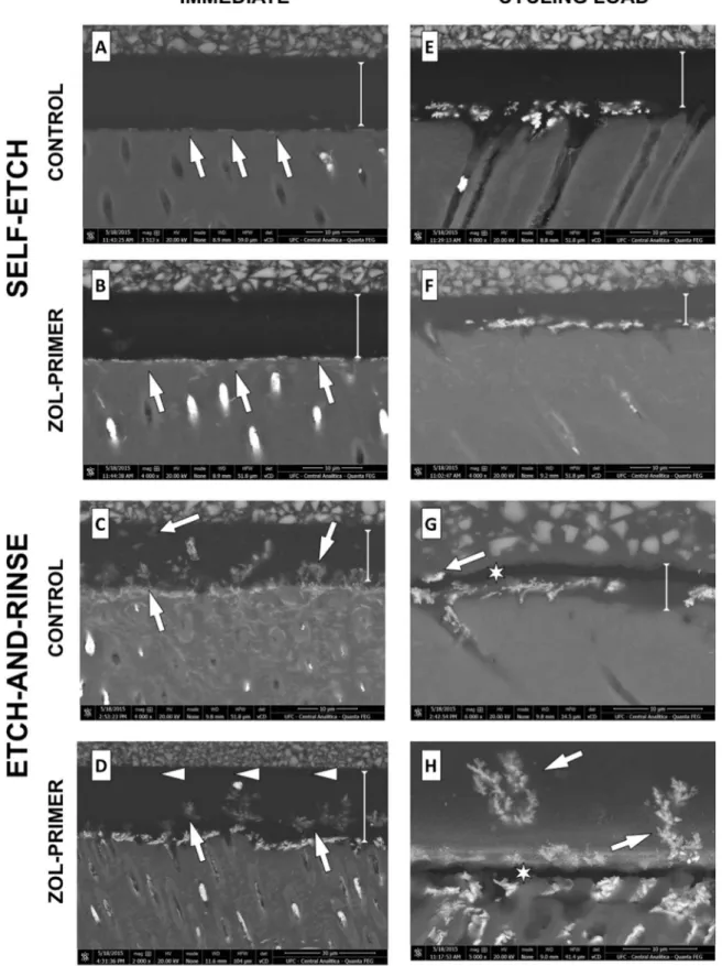 Fig. 1. Scanning electron representative micrographs of resin-dentin specimens impregnated with silver nitrate