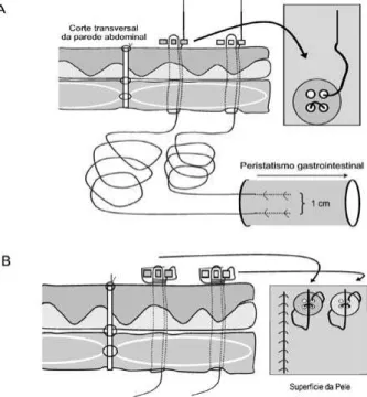 FIGURA 1 – Figura de um sistema de fixação dos eletrodos no trato gastrointestinal de animais de experimentação.