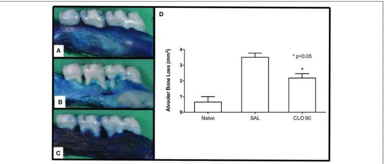 FIGURE 1 | Effect of CLO on ABL in rats with EP. Naoïve hemimaxilla (A), Hemimaxilla from SAL group (B), Hemimaxilla tretated with CLO 90 mg/kg (C),