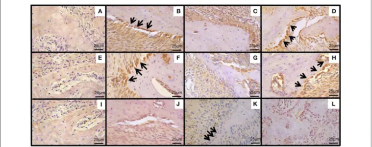 FIGURE 5 | Effect of CLO on immunoexpression of WNT pathway in periodontium of rats with