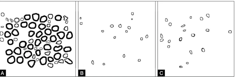 Figura 4. Quadros binários de 640 x 470 pixels. Contorno das fibras mielínicas de cada grupo: Normal(A), Controle(B) e Tratado(C)