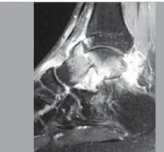 Figura 1F. Radiografia no pós-operatório (vista ântero-posterior).