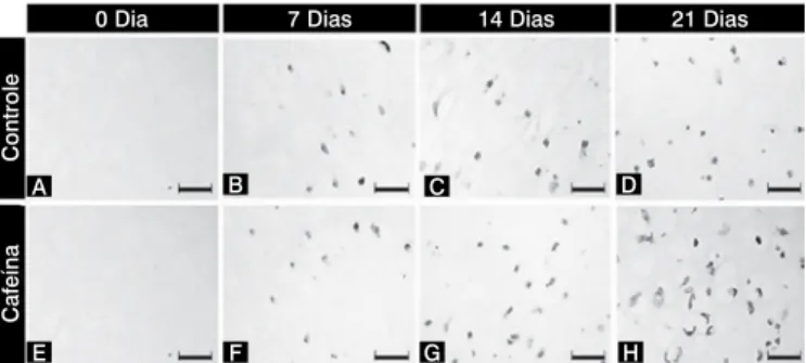 Tabela 4. Média, desvio-padrão e resultado da análise estatística do  número de condroblastos apoptóticos/campo marcado pela técnica de  túnel nas epífises cartilaginosas do fêmur de ratos neonatos cultivadas  em meio com ou sem cafeína (controle).