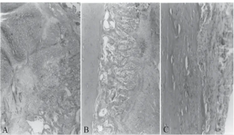 Figura 1. Fotomicrografia de fraturas da tíbia de ratos no Grupo A (Vitamina 