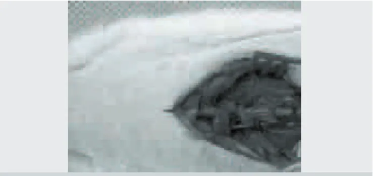 Figura 1. Planejamento de incisão.